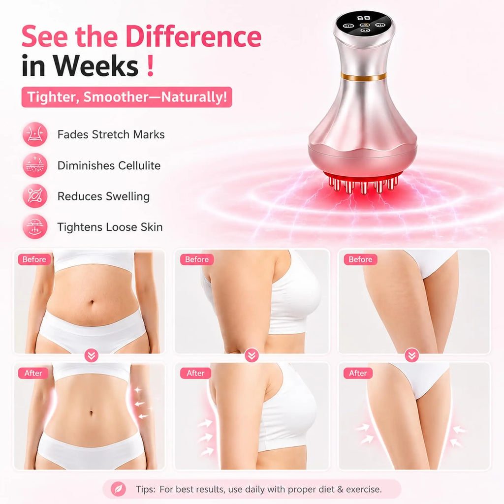 Masajeador corporal inalámbrico 4 en 1 para adelgazar, anticelulítico, con terapia de luz roja, EMS, masaje meridiano eléctrico, dispositivo de relajación corporal