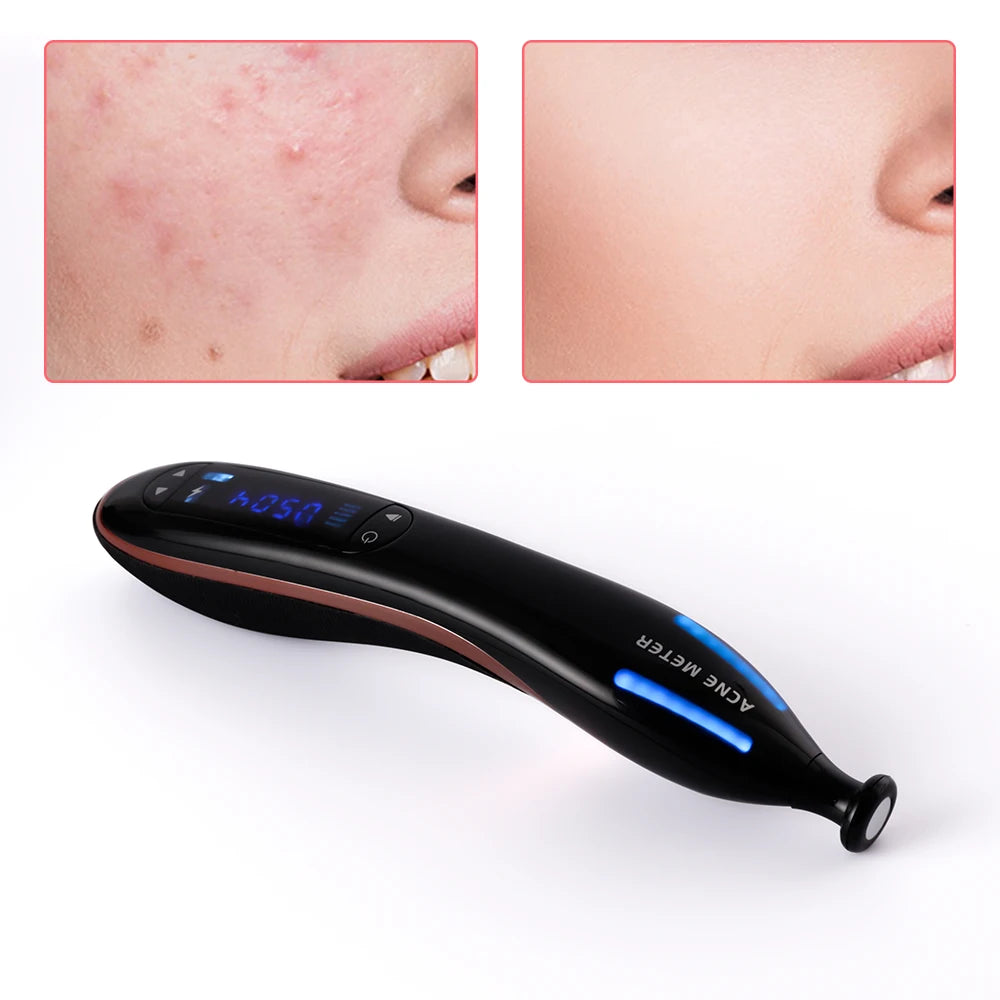 Pluma de Plasma de luz azul para eliminación de cicatrices y acné, terapia de envejecimiento antiarrugas, dispositivo de belleza, máquina para el cuidado de la piel Facial