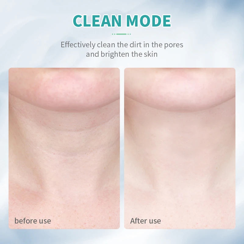 ANLAN Dispositivo de belleza para la cara del cuello Levantamiento de cuello facial EMS Cuidado de la piel con calor ligero en 3 colores Estiramiento de la piel Reducir la papada Herramientas para el cuidado de la piel