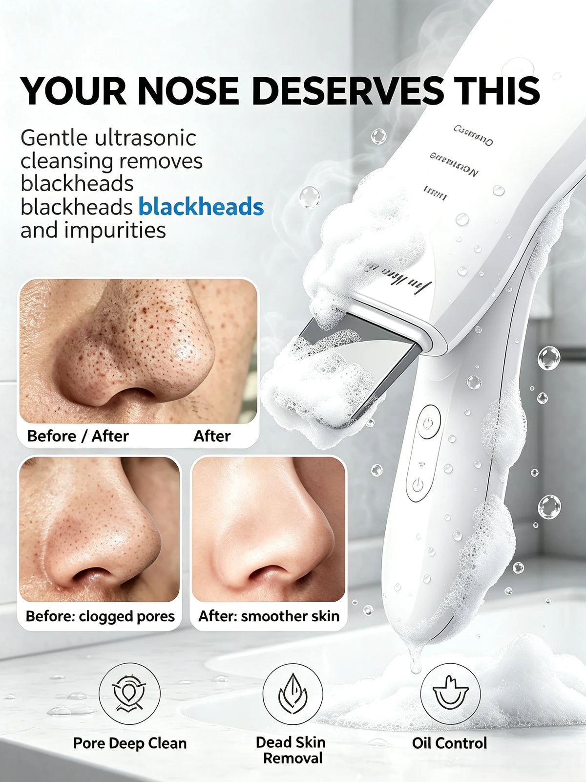 Espátula Ultrasónica para la Piel con 4 Modos, Removedor de Puntos Negros, Limpiador Facial Profundo, Exfoliante, Control de Grasa, Antienvejecimiento