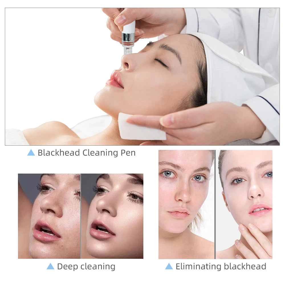 Máquina de Rejuvenecimiento Facial Miss Queeny H2O2 Small Bubble 7 en 1 con Máscara LED, Envío Rápido