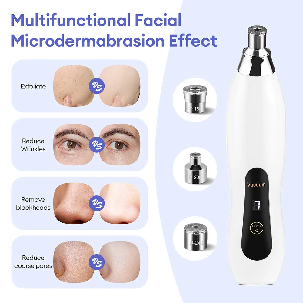 Máquina peladora de diamantes portátil, microdermoabrasión Facial, limpieza profunda, dispositivo de cuidado de la piel, exfoliación al vacío, eliminador de espinillas