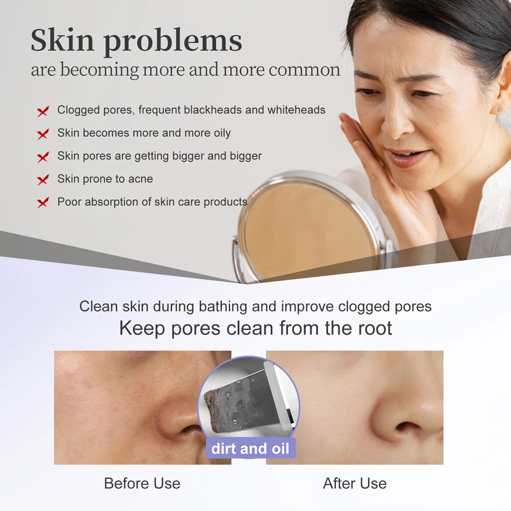 ANLAN Exfoliante Ultrasónico para la Piel, Peeling Facial Ultrasónico, Lifting Facial, LED Rojo y Azul, Máquina de Limpieza Profunda de Poros, IPX7