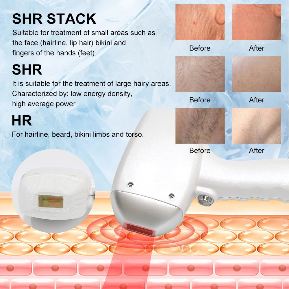 Máquina de depilación láser de diodo profesional 2 en 1, indolora y permanente, 755 808 1064, máquina de depilación láser de diodo 2 en 1 de 4000W, máquina de eliminación de tatuajes Pico Qswitch ND YAG 808