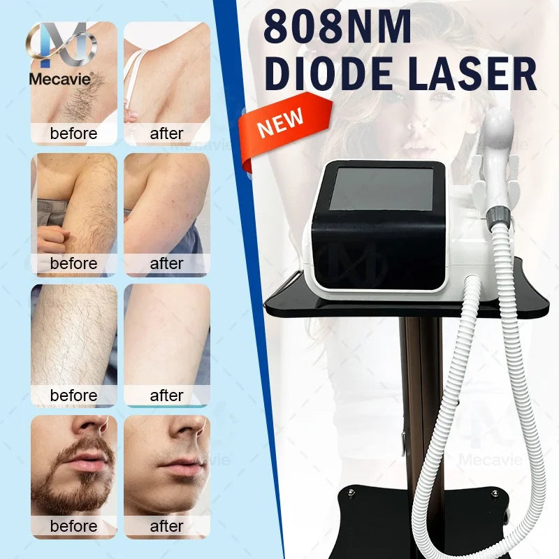 Dispositivo profesional de depilación láser con diodo de 808 nm, tecnología de enfriamiento con hielo para una aplicación indolora, para el rostro, el cuerpo y la zona del bikini, máquina de belleza para salones de esté