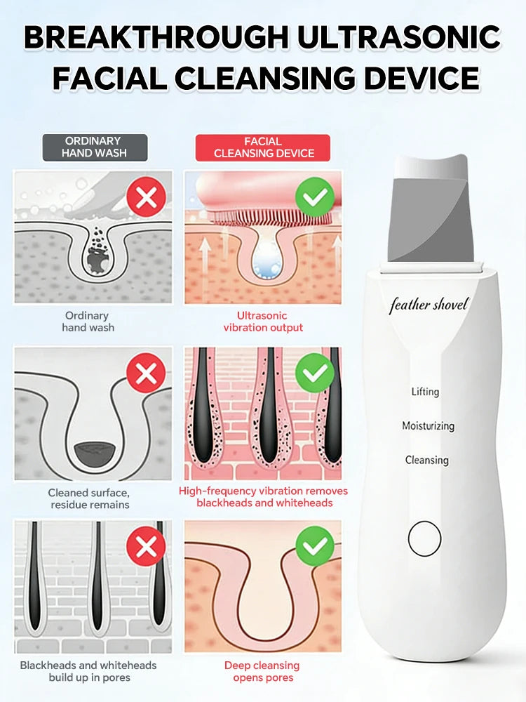 Limpiador Facial Ultrasónico, Removedor de Puntos Negros, Limpiador de Poros Profundos, Exfoliante