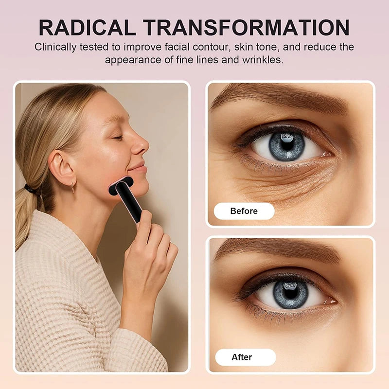 Dispositivo EMS para Lifting Facial, Varita Facial con 7 Colores de Luz, Masajeador Facial y Ocular, Reafirmante de Piel, Antiarrugas, Herramienta de Belleza para el Cuidado de la Piel