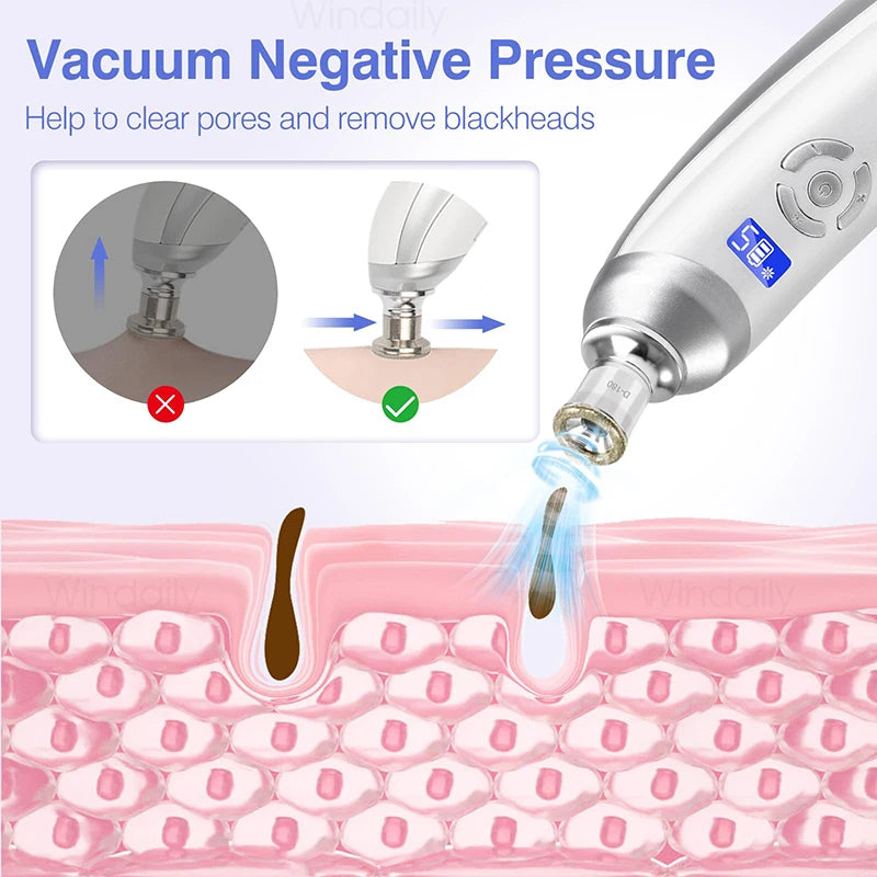 Máquina de microdermoabrasión de diamante inalámbrica 2025, eliminador de espinillas, limpiador de poros al vacío, herramienta de cuidado de la piel Facial, dispositivo de belleza Facial