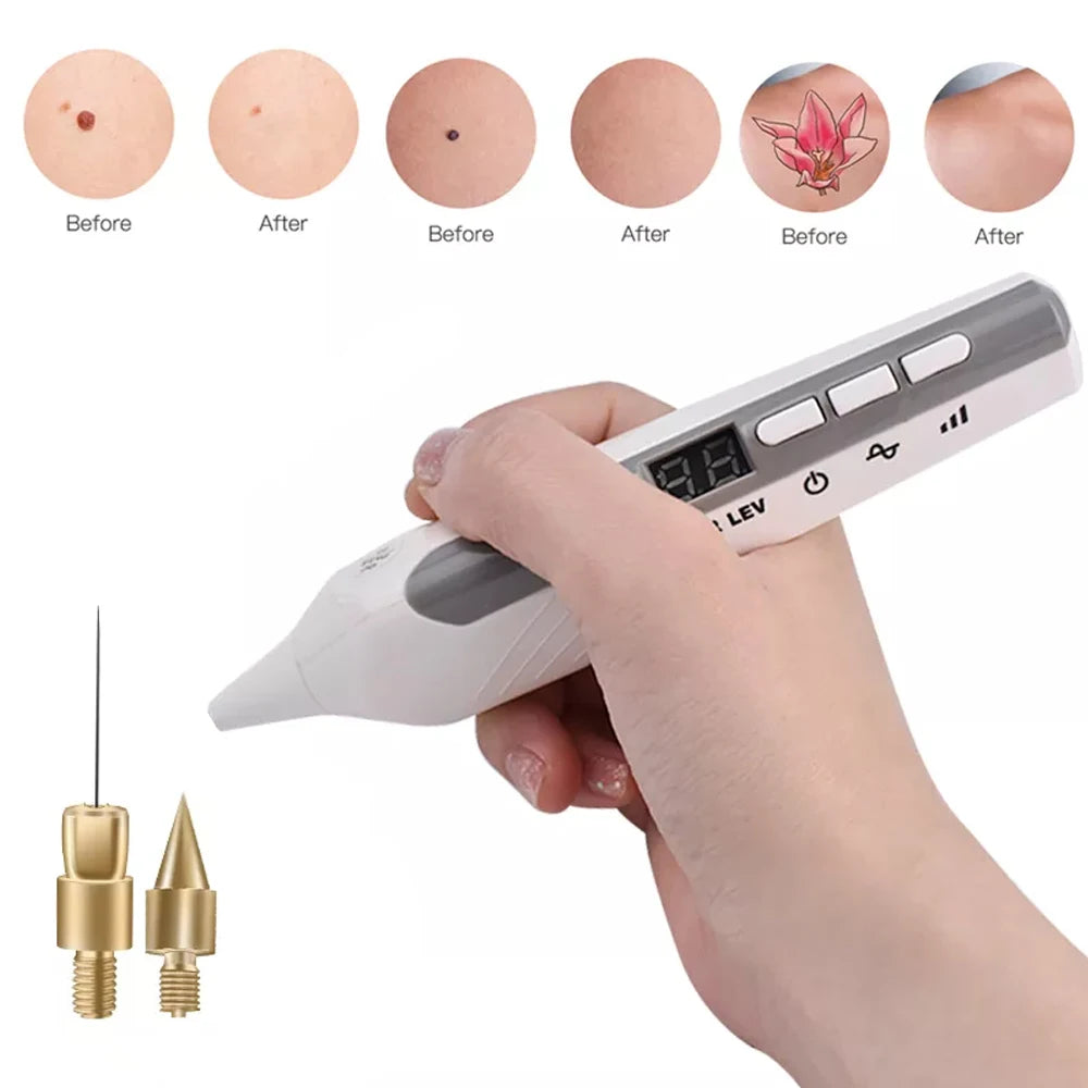 Máquina de eliminación de verrugas y pecas con 9 niveles, lápiz de plasma LCD para eliminar lunares, manchas negras, tatuajes y acrocordones, herramientas de cuidado de la belleza