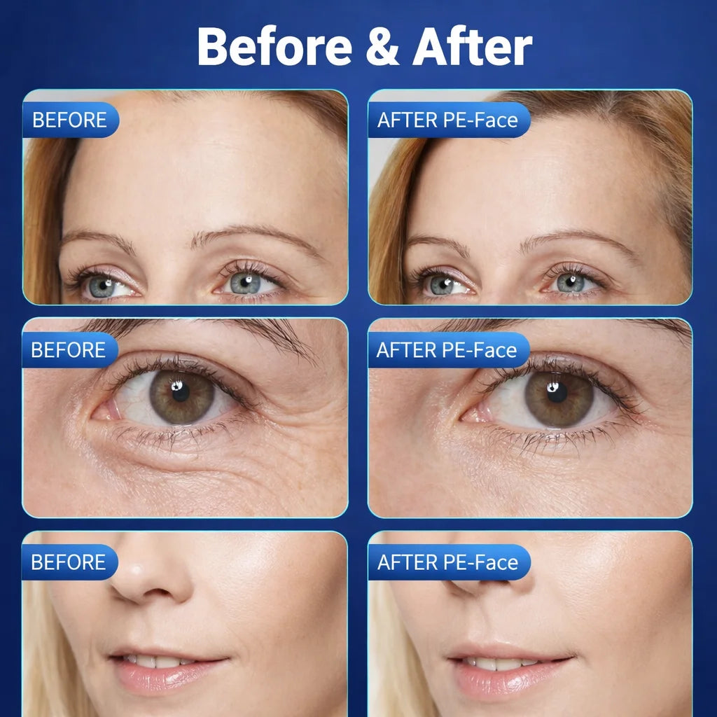 Nuevo Dispositivo de Belleza Facial MYOslim con Temperatura, Microcorriente, Onda Electromagnética, Reafirma la Piel, Reduce las Arrugas, Uso Doméstico
