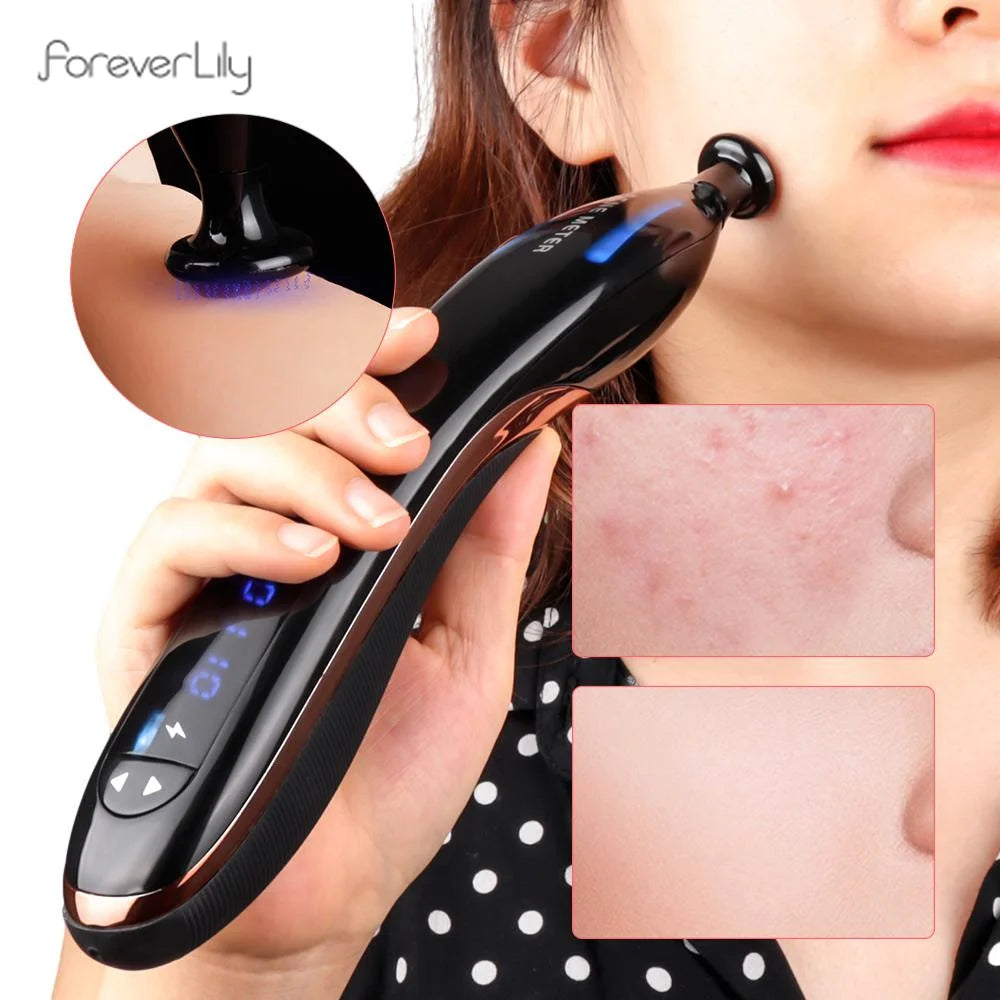 Pluma de Plasma de luz azul para eliminación de cicatrices y acné, terapia de envejecimiento antiarrugas, dispositivo de belleza, máquina para el cuidado de la piel Facial