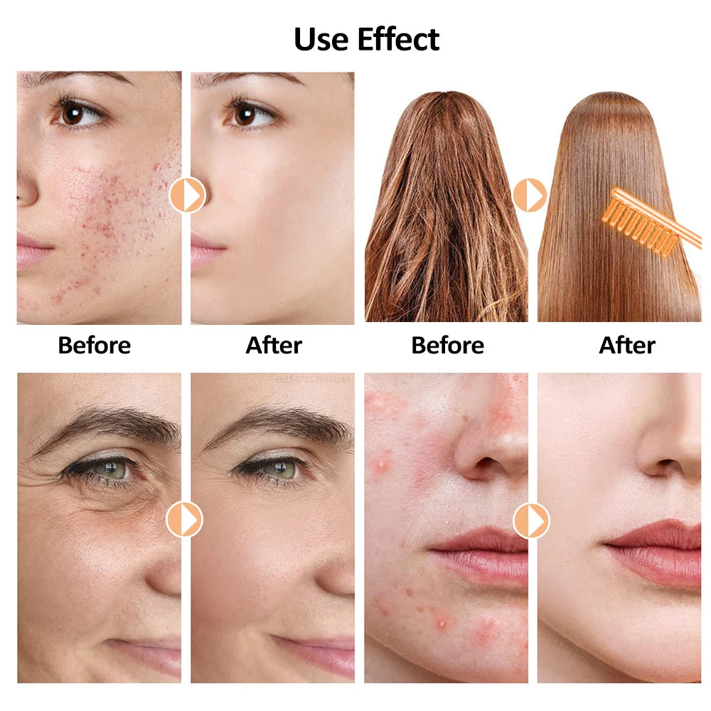 Máquina facial portátil de alta frecuencia, varita de electroterapia, tubo de vidrio con electrodos, dispositivo para reducir arrugas en la piel, herramientas para el cuidado de la piel del rostro.