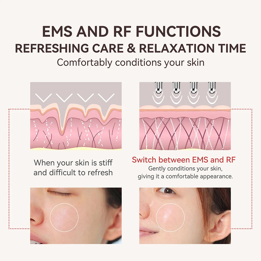 ANLAN Masajeador de puntos de acupuntura RF Diseño de doble cabezal y modo dual EMS alivia la fatiga RF+EMS reafirmante Dispositivo de belleza para el cuidado facial