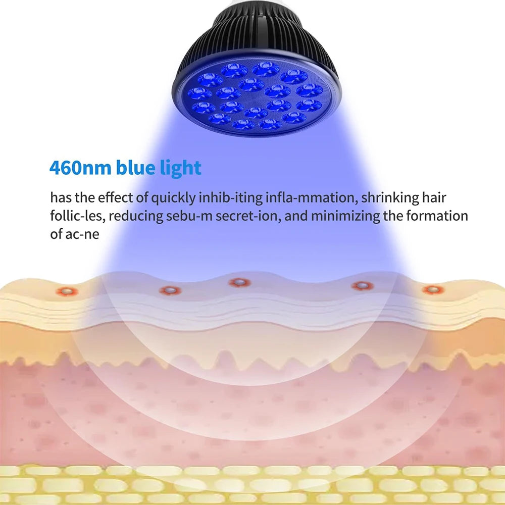 Lámpara de terapia de bronceado con luz azul de 18 LED, 460nm, para el cuidado de la piel de la cara y el cuerpo, eliminación de manchas de acné, dispositivo de fisioterapia, lámpara de belleza