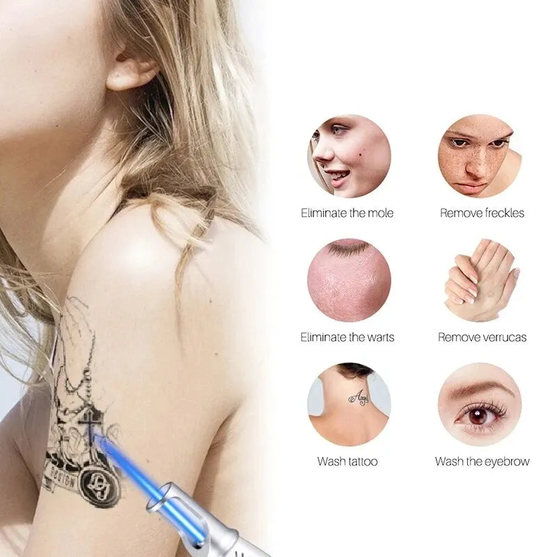 Puntero láser de picosegundos para eliminación de lunares, pluma de eliminación de manchas oscuras, tatuaje, acné, pigmento de la piel, máquina portátil de eliminación, dispositivo de belleza