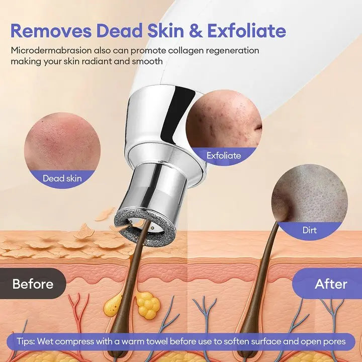 Máquina peladora de diamantes portátil, microdermoabrasión Facial, limpieza profunda, dispositivo de cuidado de la piel, exfoliación al vacío, eliminador de espinillas