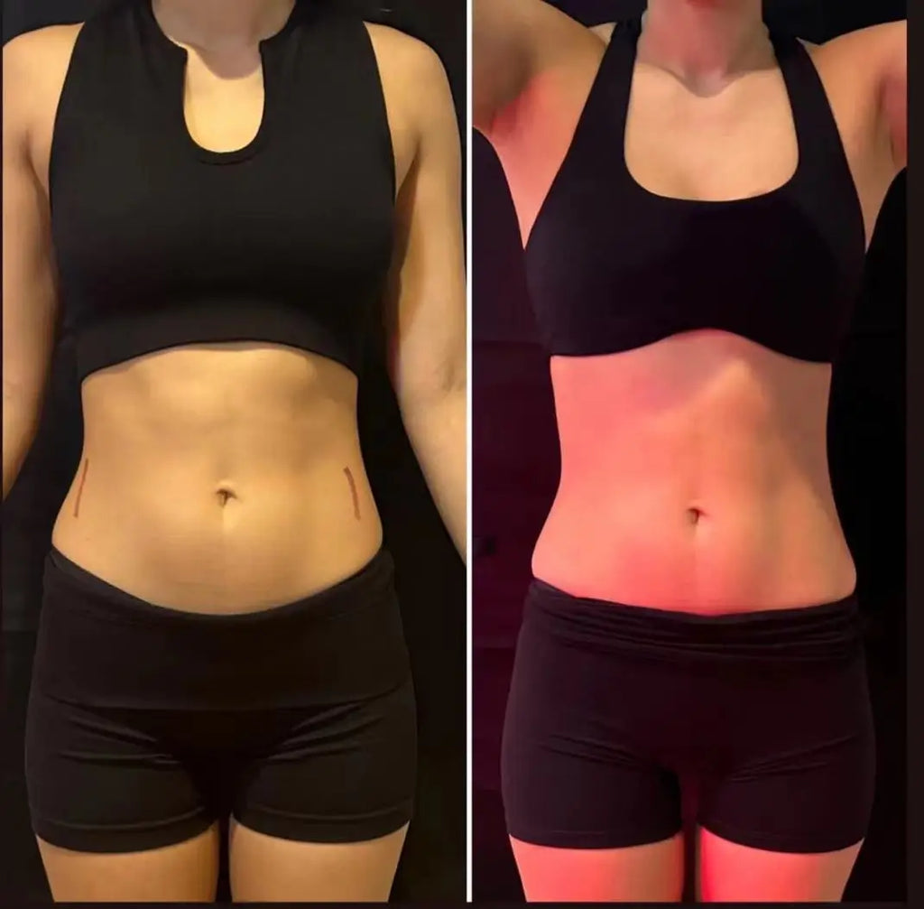 Máquina Portátil de Contorno Corporal por Radiofrecuencia Myoslim Electromagnetic Muscle Builder de 15 Tesla y 6500W para Adelgazar y Perder Peso