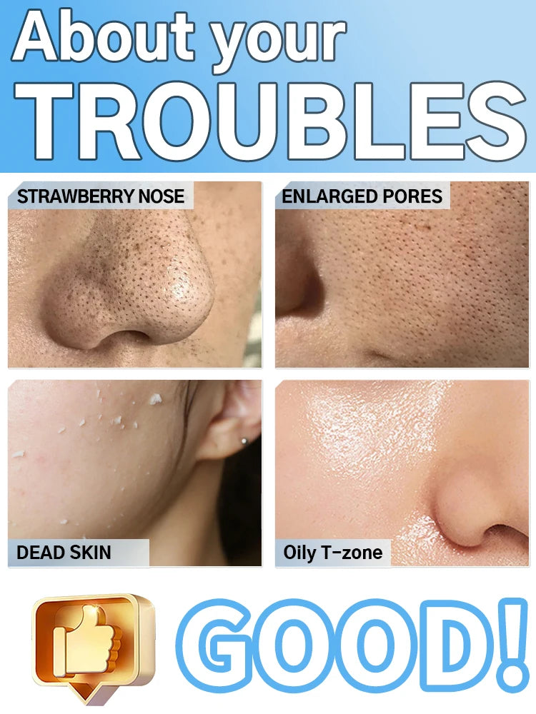 Espátula Ultrasónica para la Piel con 4 Modos, Removedor de Puntos Negros, Limpiador Facial Profundo, Exfoliante, Control de Grasa, Antienvejecimiento