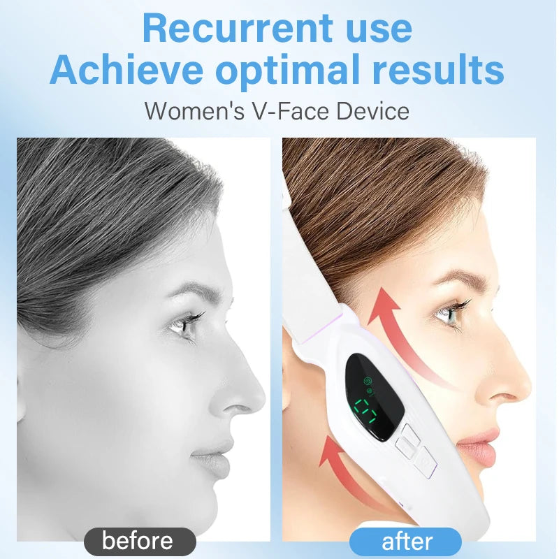 Máquina Eléctrica Reductora de Doble Mentón en Forma de V, Dispositivo de Belleza Facial, Masajeador Adelgazante Facial para Mejorar la Línea de la Mandíbula
