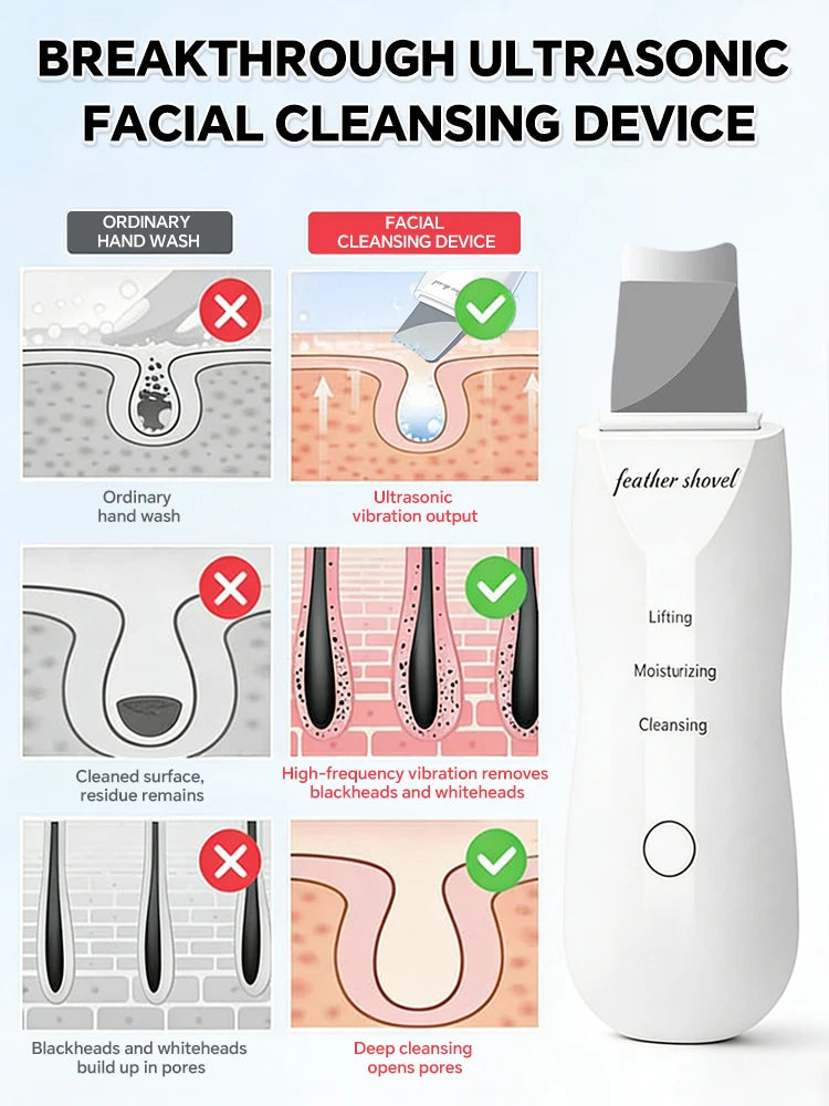 Espátula Ultrasónica para la Piel con 4 Modos, Removedor de Puntos Negros, Limpiador Facial Profundo, Exfoliante, Control de Grasa, Antienvejecimiento