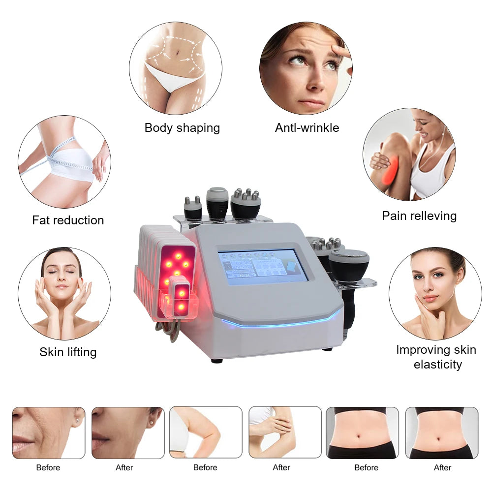 Máquina de Belleza 7 en 1 para Adelgazar el Cuerpo, Cavitación Ultrasónica de 120K, Pérdida de Peso, Rejuvenecimiento de la Piel, Eliminación de Celulitis, Lifting Facial
