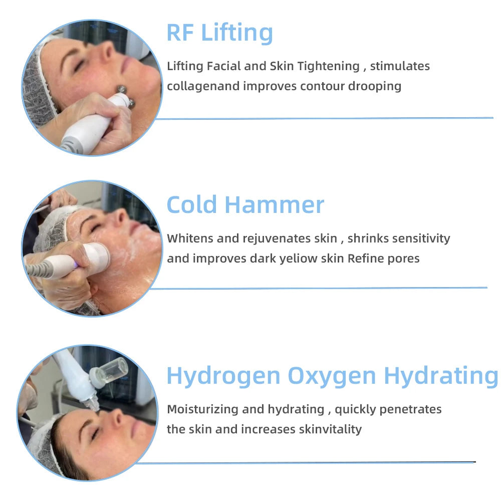 Máquina Facial Profesional Missheart 7 en 1 de Hidro-Oxígeno con Burbujas Pequeñas — Dispositivo de Hidradermoabrasión para Limpieza Profunda y Rejuvenecimiento de la Piel