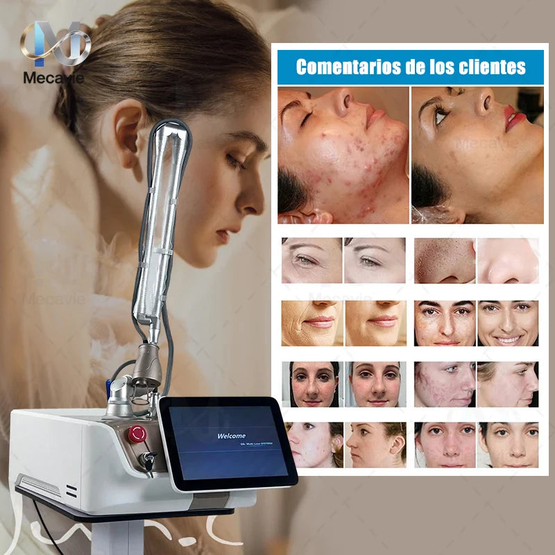 Máquina portátil de eliminación de cicatrices con láser fraccionado de CO2, sin dolor: elimina tatuajes, manchas, acné, antienvejecimiento, reduce las arrugas, tensa y aclara la piel.