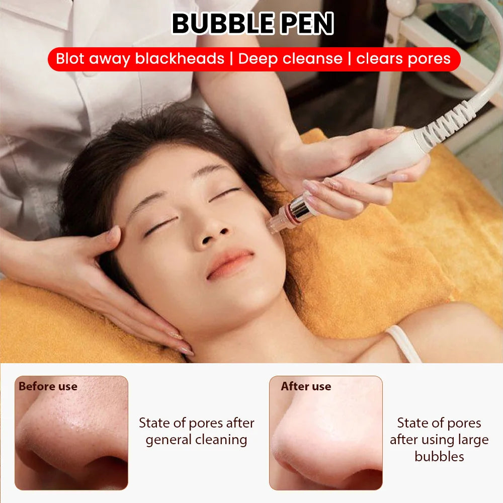Máquina Profesional de Hidrodermoabrasión 6 en 1, 350W, Oxígeno Facial, Eliminación de Puntos Negros, Hidratación de la Piel, Peeling de Agua, Equipo de Belleza