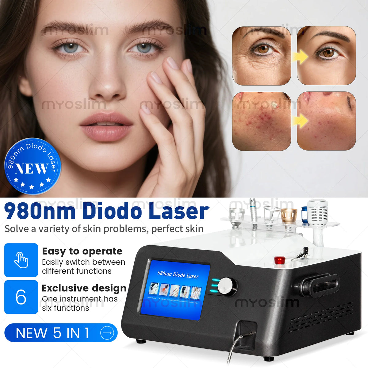 NUEVA Máquina de Belleza Diodo 5 en 1 de 980nm, 30W de Potencia, Equipo Profesional de Salón con 6 Cabezales de Tratamiento para Cuidado Vascular y Hongos en las Uñas