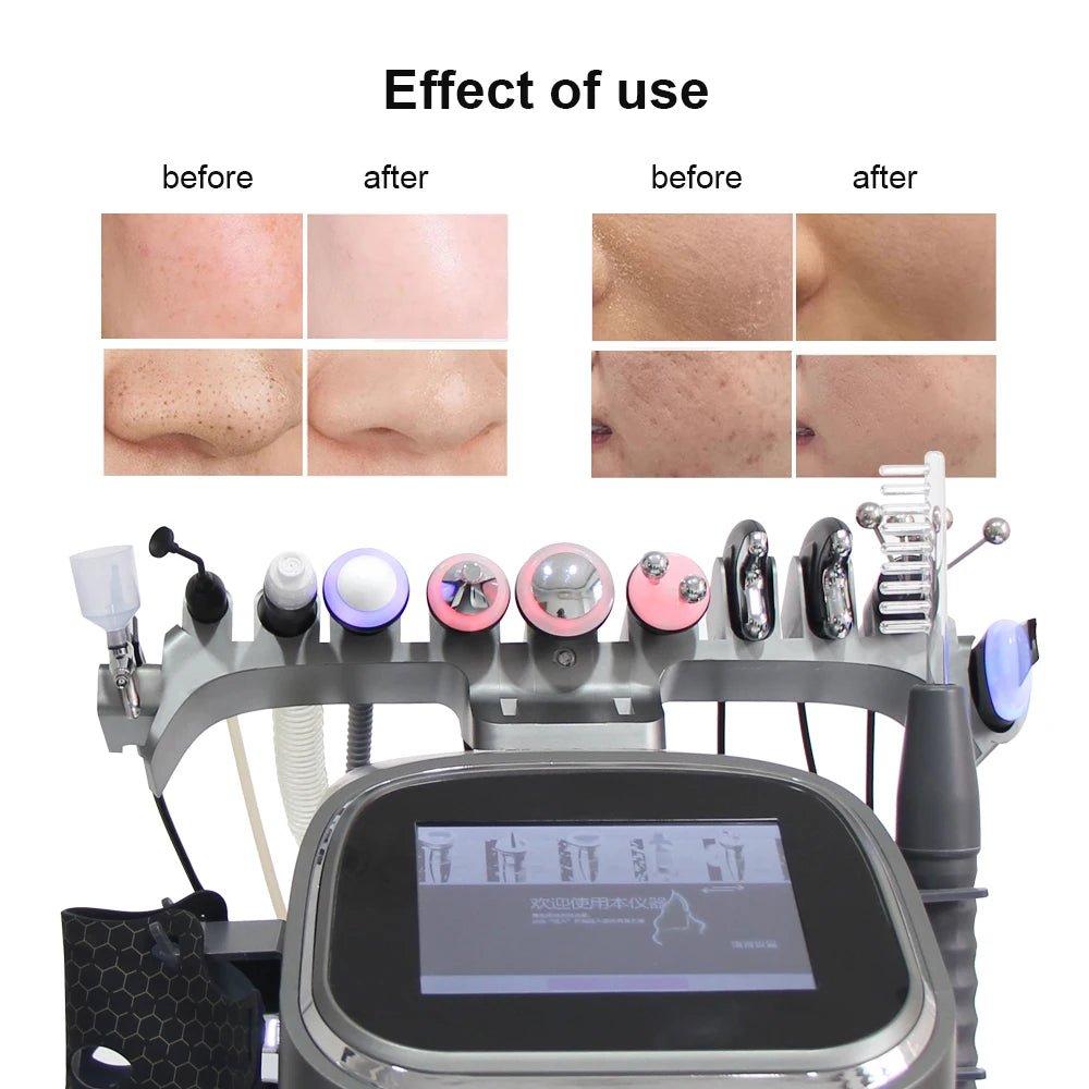 Equipo Profesional 12 en 1 para el Cuidado de la Piel, Hidratante de Burbujas, Máquina de Oxígeno, Limpieza Facial, Dermoabrasión