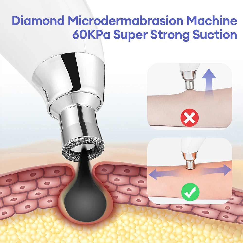 Máquina peladora de diamantes portátil, microdermoabrasión Facial, limpieza profunda, dispositivo de cuidado de la piel, exfoliación al vacío, eliminador de espinillas