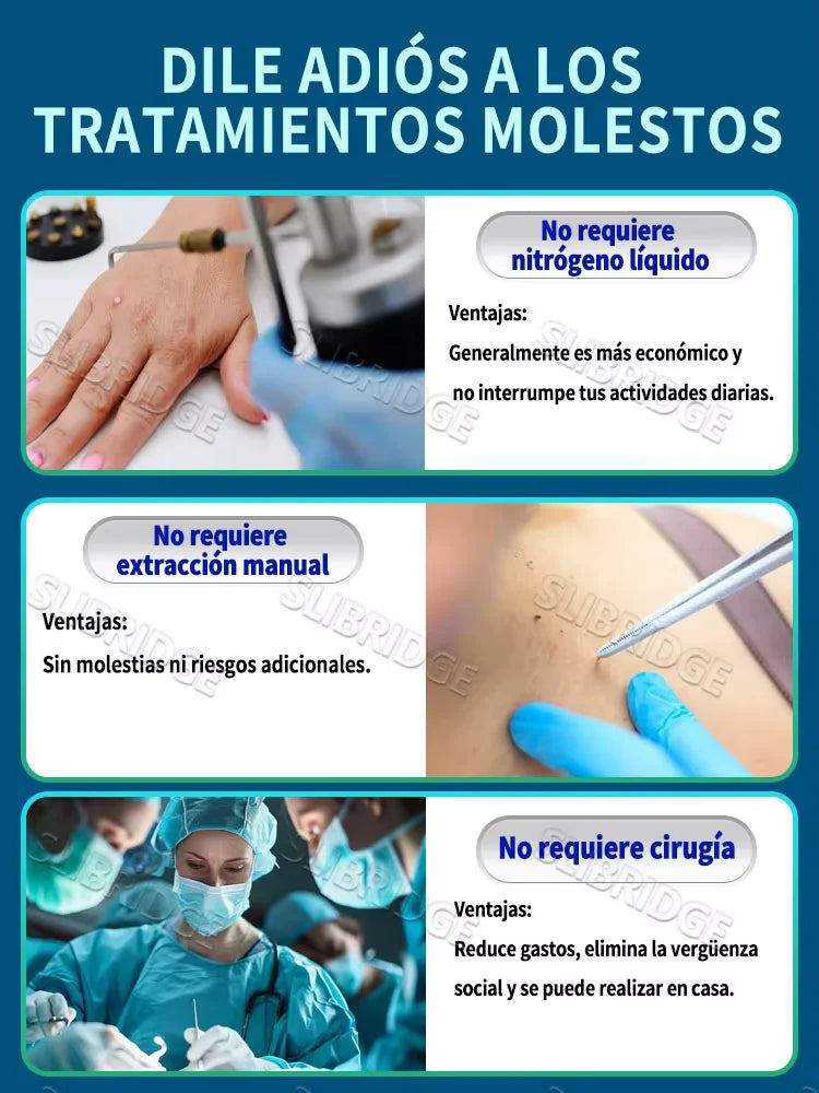 Lápiz de Plasma para Eliminación de Verrugas y Lunares, con 5 Puntas de Aguja y Toallitas con Alcohol