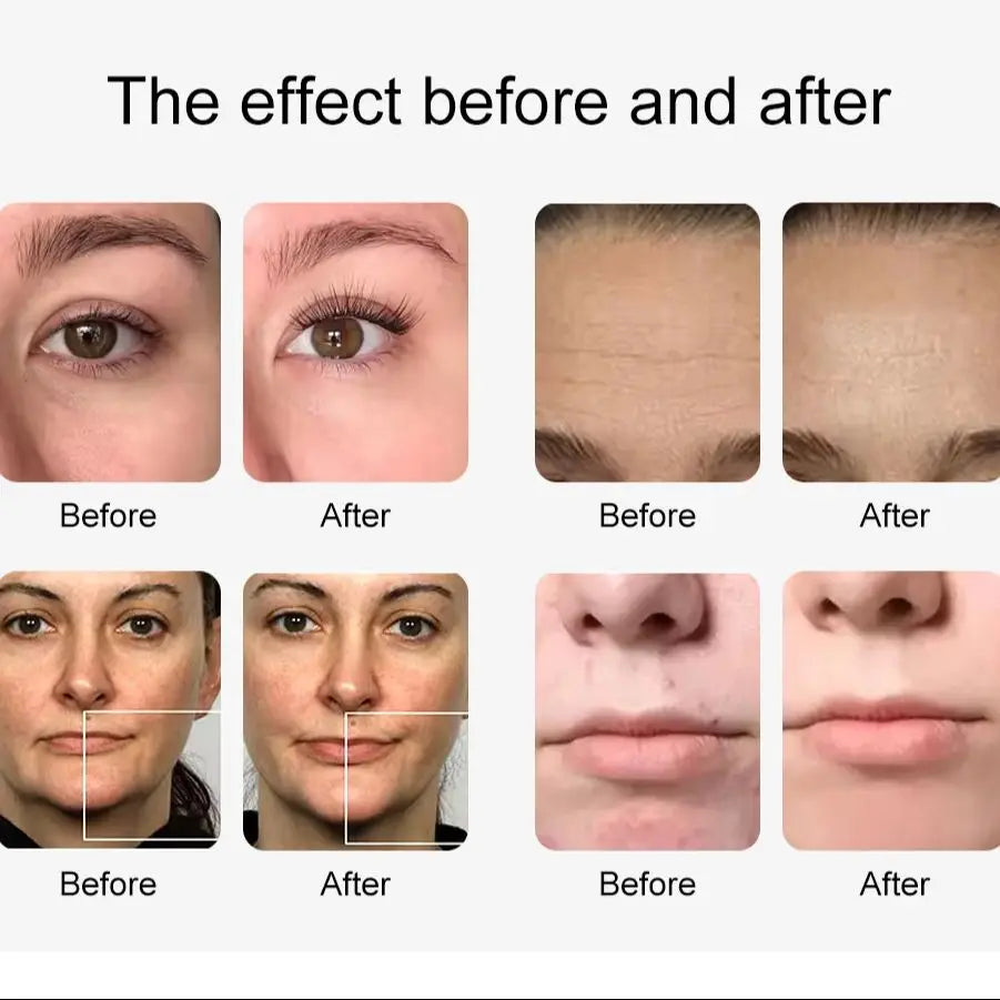 Máquina hidráulica de oxígeno y agua 12 en 1, estiramiento facial, limpieza profunda, Dermoabrasión, máquina peladora de agua, rejuvenecimiento de la piel, burbuja pequeña