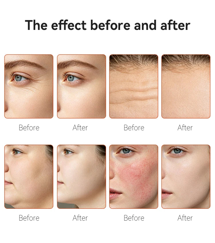Novlora 10 en 1 Máquina Facial de Hidro-Oxígeno Ice Skin, Limpieza Profunda, Eliminador de Puntos Negros, Microdermoabrasión, Peeling Acuático, Exfoliante para la Piel, Cuidado de la Piel, SPA