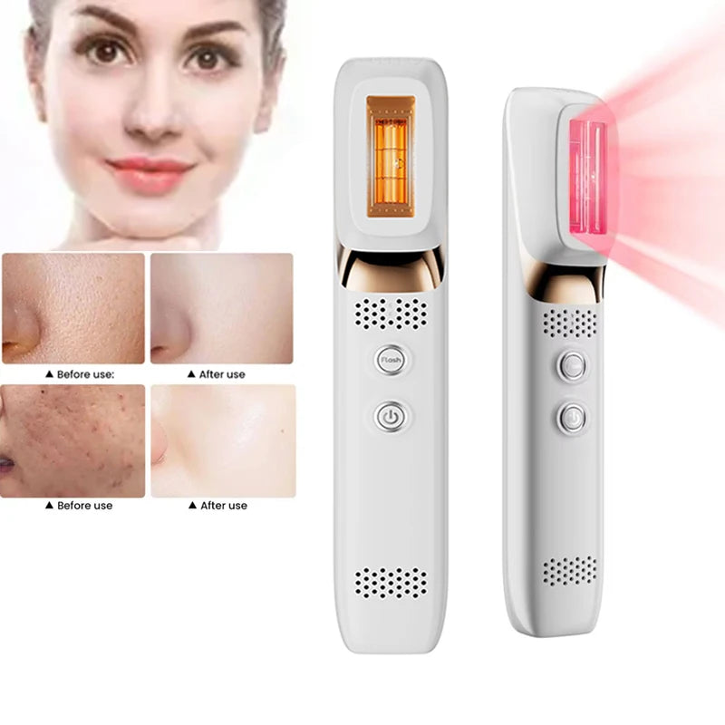 Nueva luz de leche LED + instrumento de belleza de terapia IPL con máquina de masaje Facial láser cuello cara terapia de luz roja dispositivo antienvejecimiento
