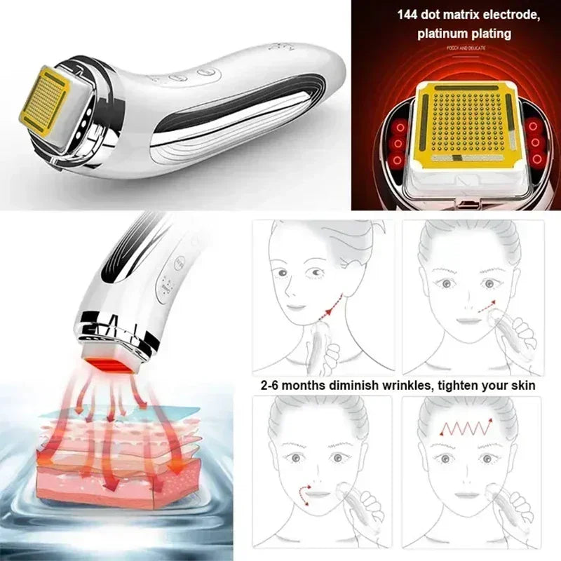 Máquina de Lifting Facial de radiofrecuencia RF, masajeador Facial de radiofrecuencia, rejuvenecimiento de la piel, eliminación de arrugas