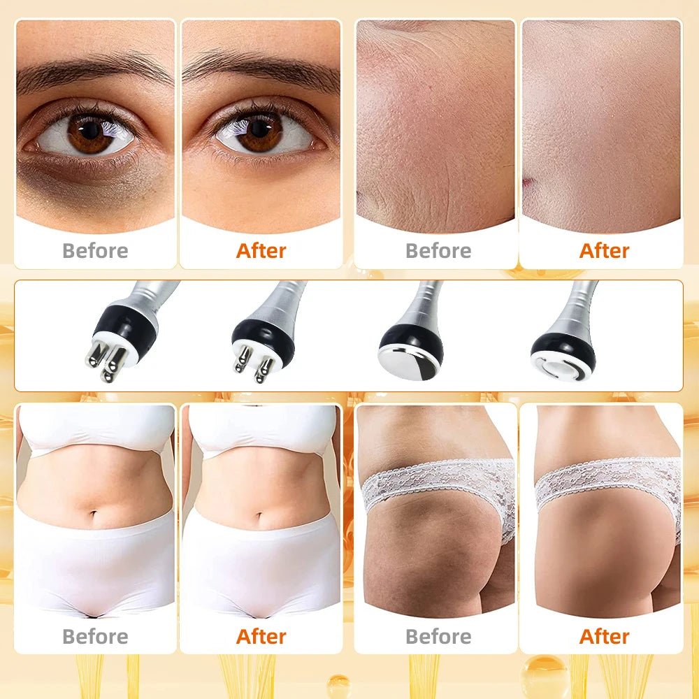 Máquina de Cavitación y Masaje Adelgazante Moonic 4 en 1 40K, Equipo Multifuncional para Reafirmar y Levantar el Rostro y el Cuerpo, Herramienta para el Cuidado de la Piel para Uso en Spa
