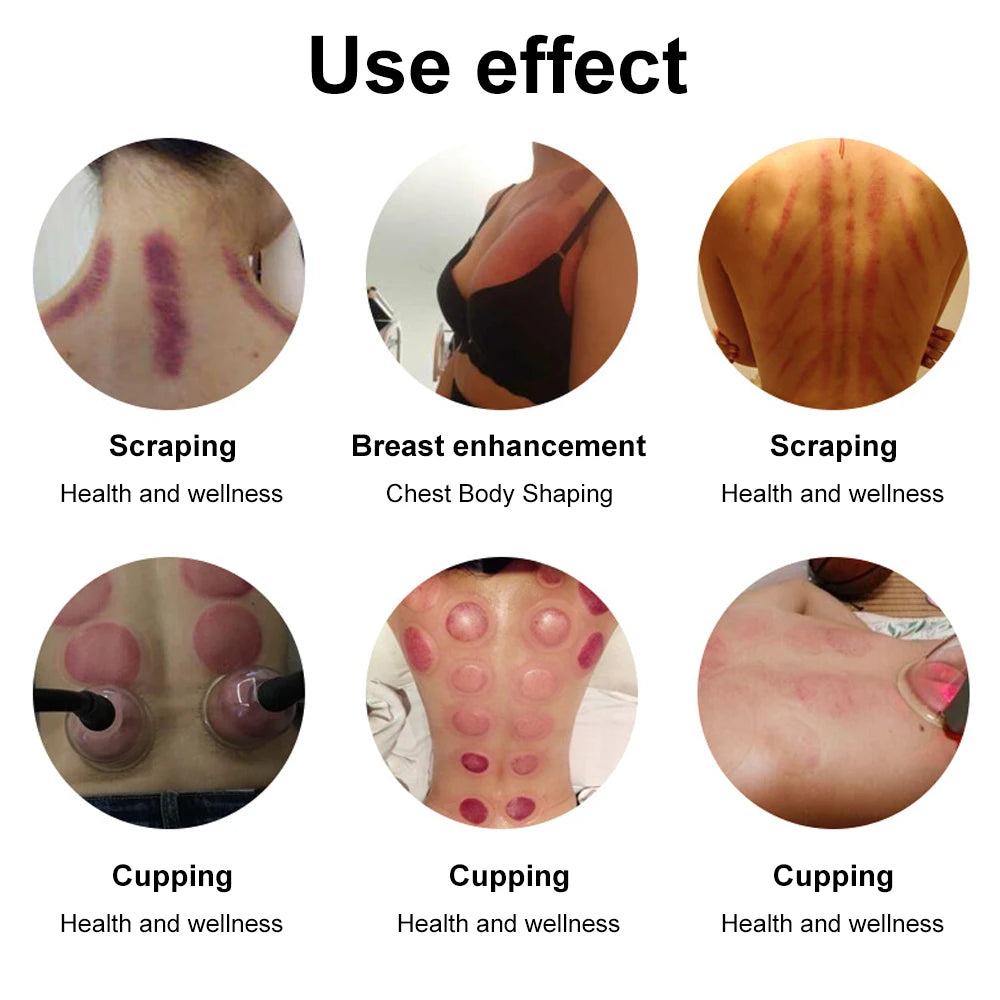 Máquina de terapia de vacío AOKO de 35 copas para aumento de senos, adelgazamiento, modelado corporal, realzador de caderas, masajeador de ventosas, levantamiento de glúteos, cuidado facial, uso en spa en casa.