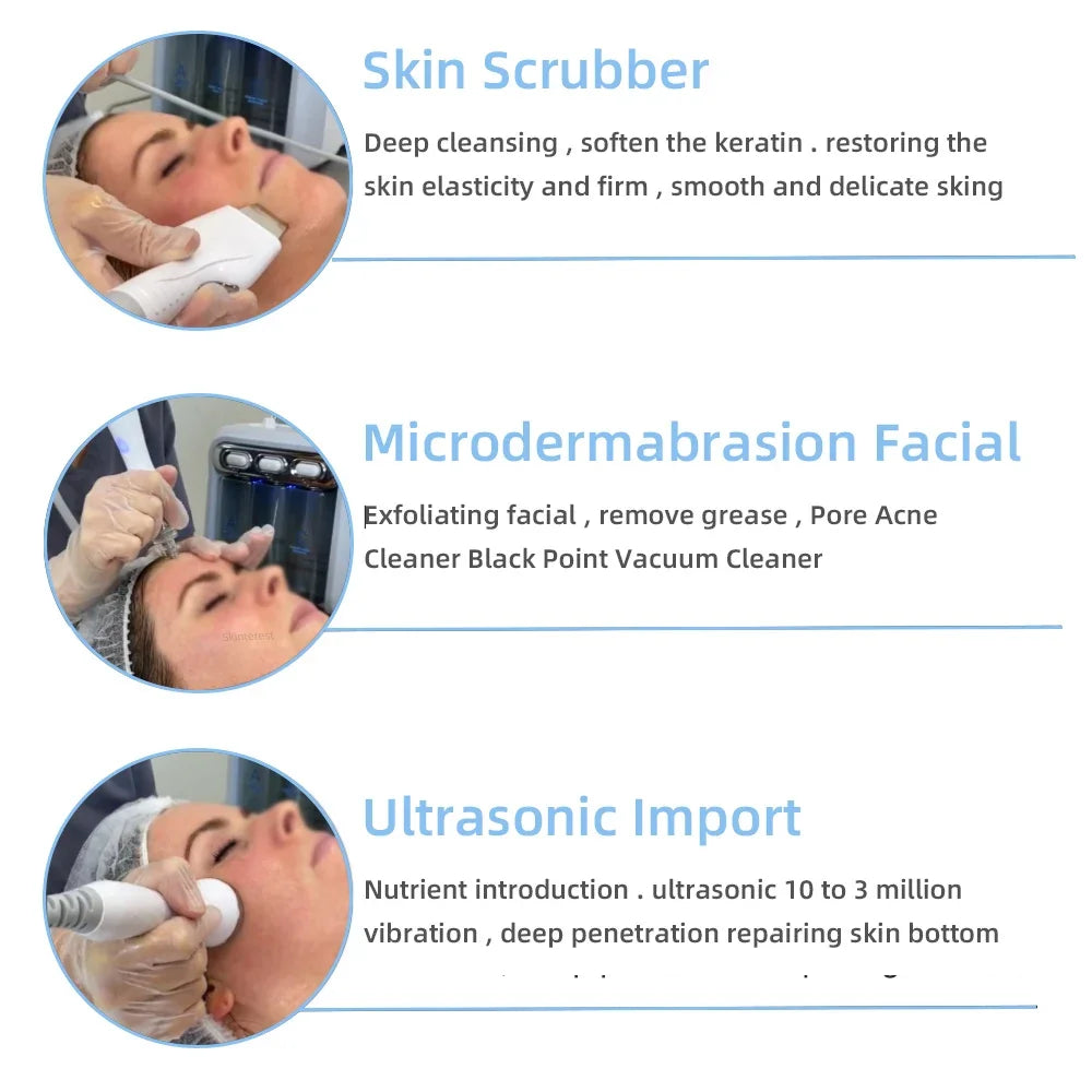Máquina de Belleza 6 en 1 Missheart con Hidro-Oxígeno y Pequeñas Burbujas, Exfoliante Facial, Spa Facial, Cuidado de la Piel, Limpieza Profunda Facial, Eliminación de Puntos Negros, Envío Rápido en la UE