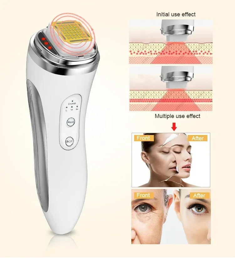 Máquina de Lifting Facial de radiofrecuencia RF, masajeador Facial de radiofrecuencia, rejuvenecimiento de la piel, eliminación de arrugas