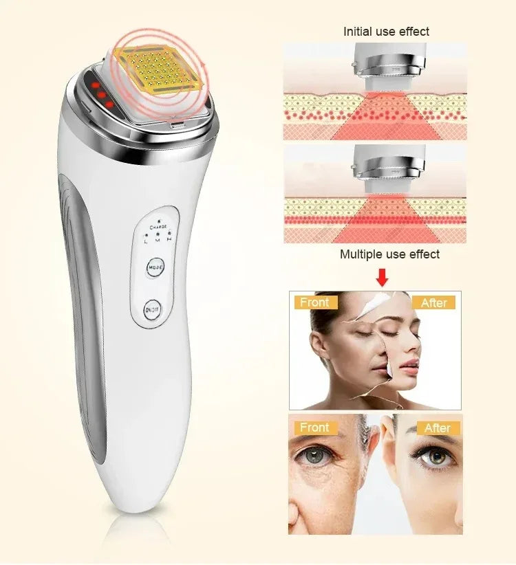 Máquina eléctrica de elevación Facial, matriz de puntos, estiramiento de la piel, rejuvenecimiento, eliminación de arrugas, masajeador Facial, dispositivos de belleza para uso doméstico