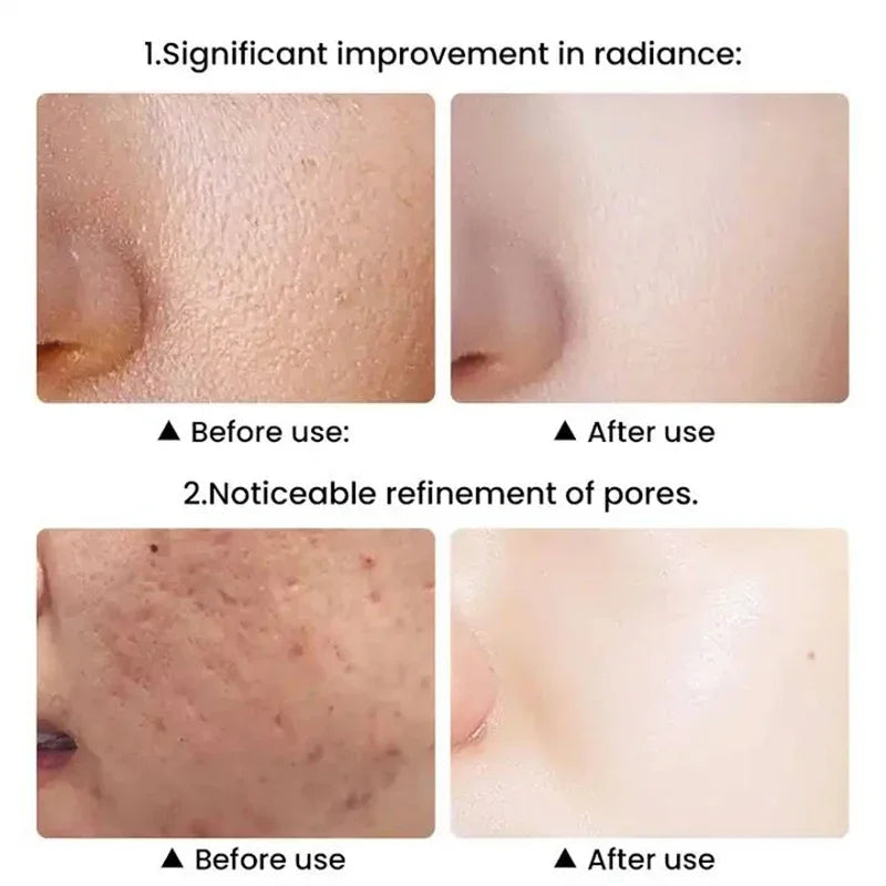 Nueva luz de leche LED + instrumento de belleza de terapia IPL con máquina de masaje Facial láser cuello cara terapia de luz roja dispositivo antienvejecimiento
