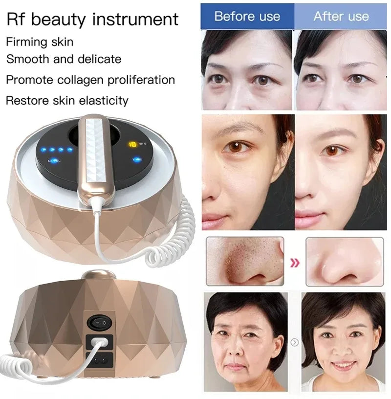 Máquina de belleza 3 en 1 con radiofrecuencia, para uso facial y corporal, con efectos antiedad, para el cuidado de la piel, el tensado y el lifting de la piel mediante radiofrecuencia.
