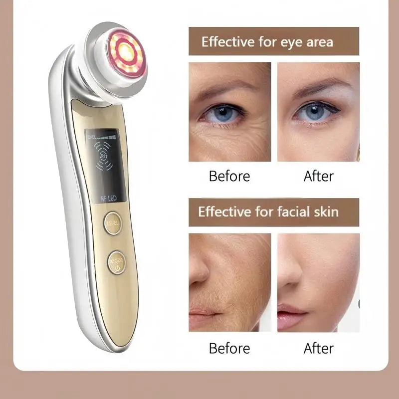 Dispositivo de Belleza Facial Multifuncional, Radiofrecuencia, EMS, Microcorriente, Luz LED, Masajeador Facial y de Cuello, Reafirmante, Hidratante, Herramienta para el Cuidado de la Piel