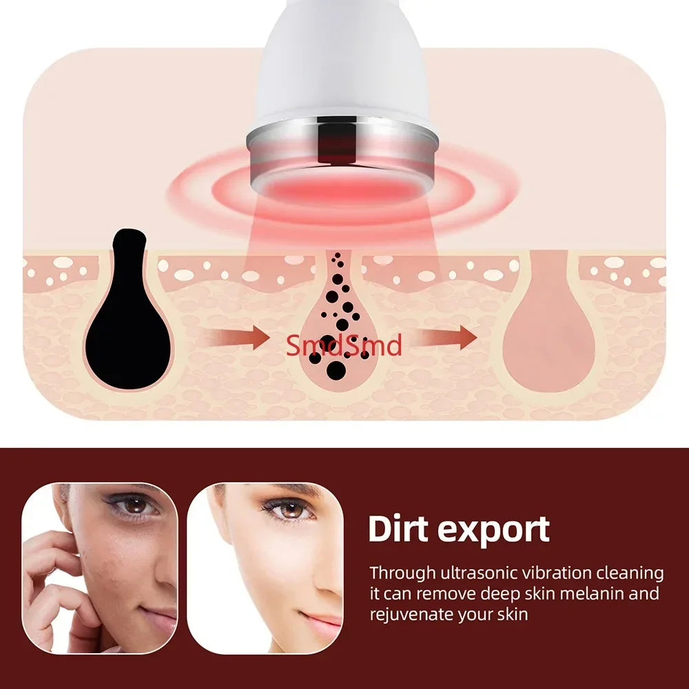 Máquina de Belleza para el Cuidado de la Piel con Ultrasonido, Antienvejecimiento, Masajeador Facial y Ocular de Alta Frecuencia, Dispositivo de Belleza Ultrasónico para Mujeres, SPA