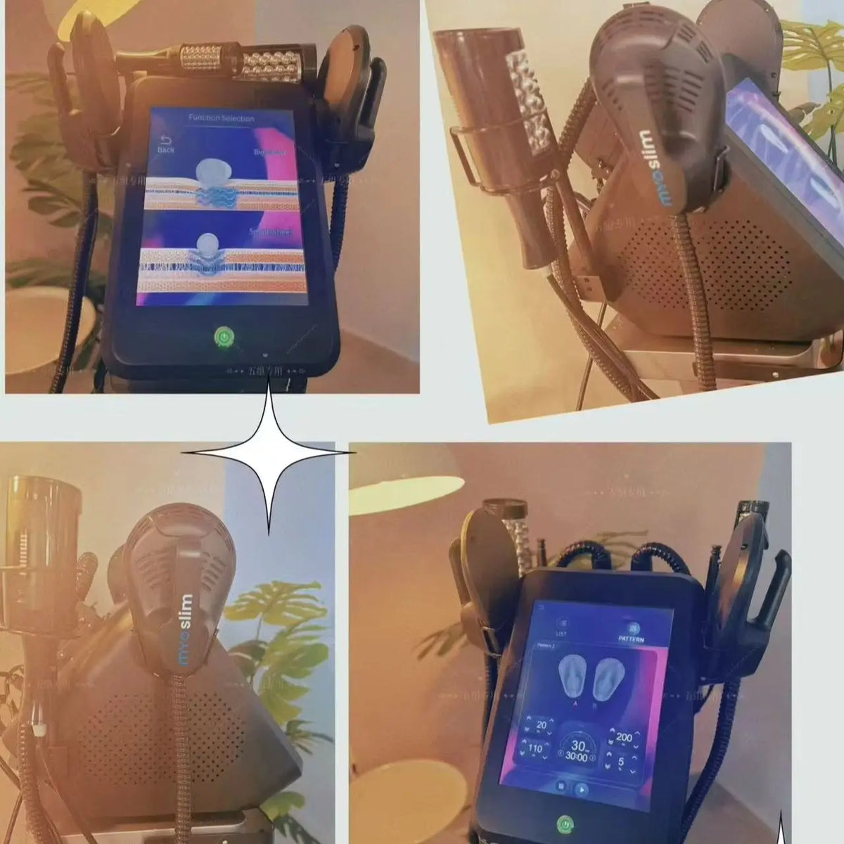 Máquina de Belleza 2 en 1 con Rodillo EMS de 200 Hz para Reducción de Celulitis, Rodillo de Bolas Interno de 360 Grados con Infrarrojos y Vacío para Masaje
