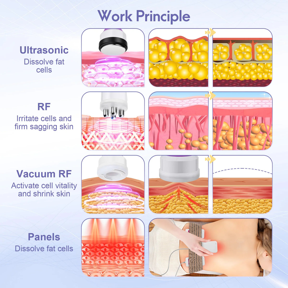Máquina de Ultrasonido 6 en 1 con Pantalla Táctil para Moldear el Cuerpo, Masajeador Láser Lipo, Cavitación, Vacío, Quema de Grasa, Eliminación de Celulitis