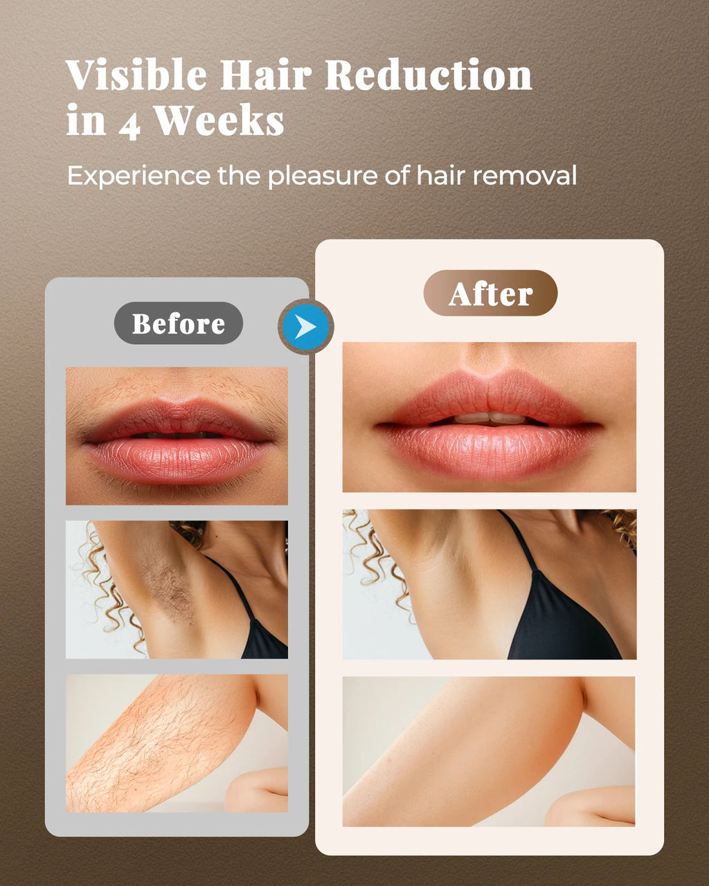 Dispositivo de Depilación IPL con 999,999 Pulsos para Mujeres y Hombres, Alternativa Segura y Prácticamente Indolora a los Dispositivos de Salón para Uso Facial, Piernas, Brazos, Bikini y Cuerpo Entero Resultados duraderos