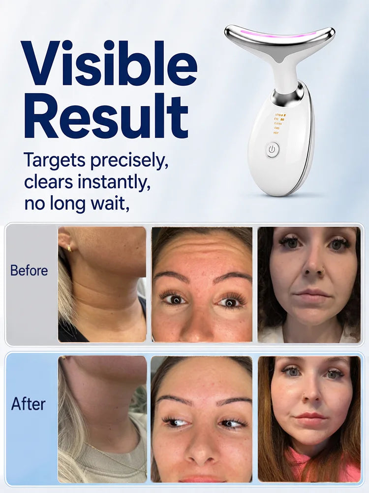 Removedor de Arrugas para Rostro y Cuello, Máquina de Lifting Facial y de Cuello, Dispositivo de Belleza para el Cuello, Máquina de Tensado de Piel