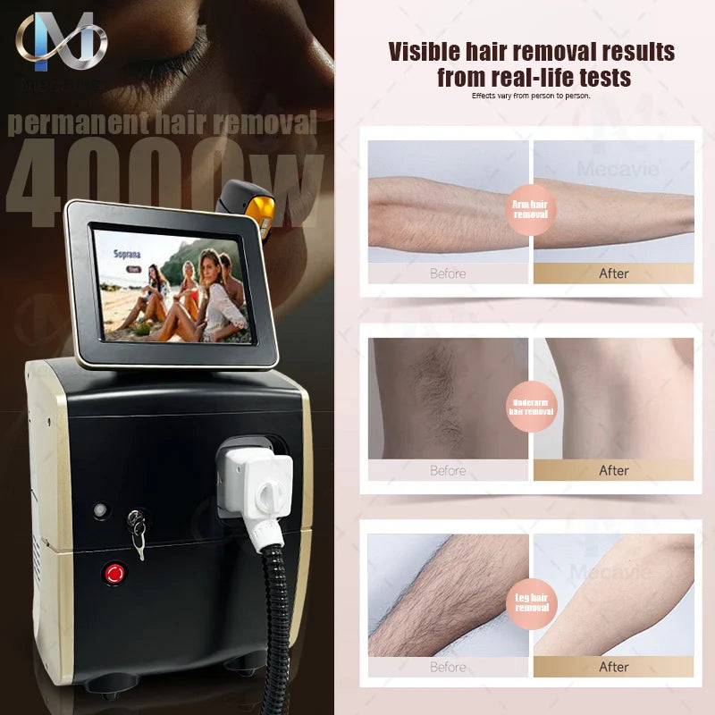 Máquina Profesional de Depilación Láser de Diodo de Titanio, Portátil, 808 830 755 940 1064, Dispositivo de 5 Ondas para Depilación Permanente